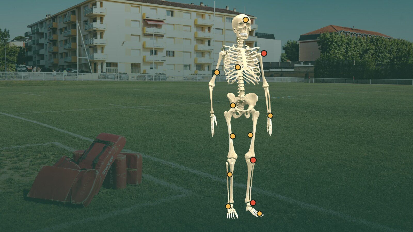 Squelette debout sur un terrain d'entraînement, avec des pastilles sur les zones où sont blessés les joueurs du Top 14, en rouge le genou, l'épaule et la cheville.